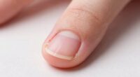 prioritize nail health awareness