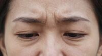stress affects skin quickly